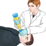 Emergency Anti-Choking Device - Image 3